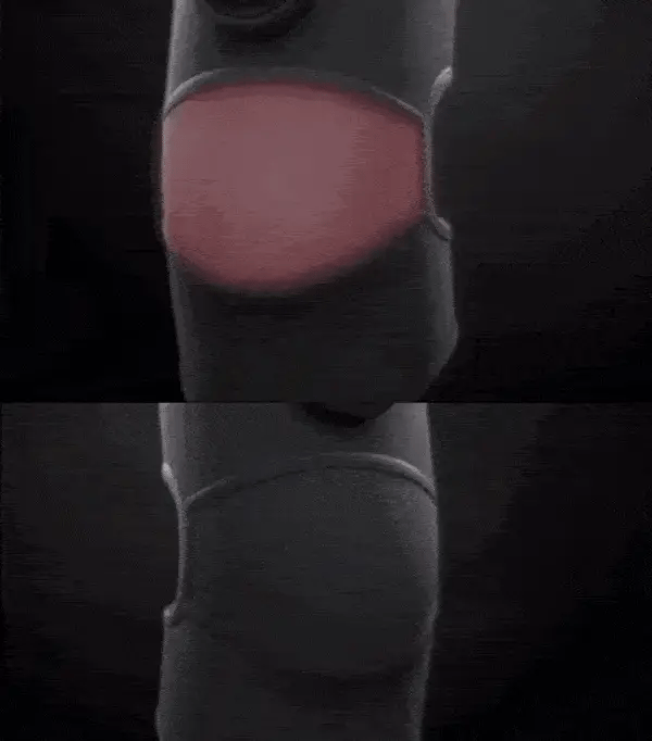 HeatRelief X - LINDRA